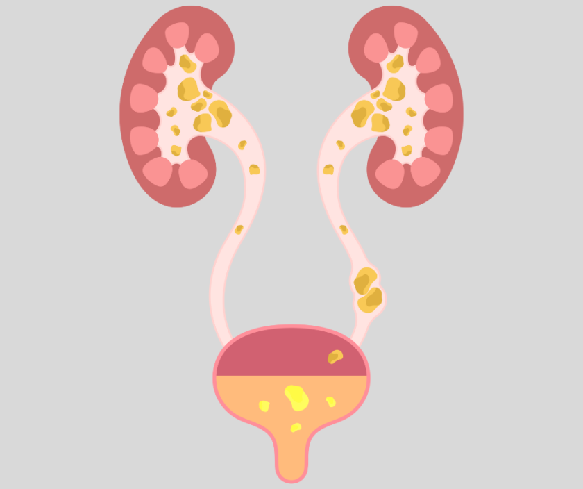 general-urology-treatment-in-lahore General Urology