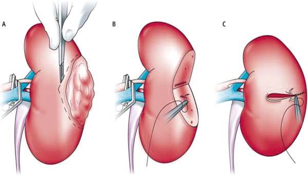 uro-oncology Uro Oncology